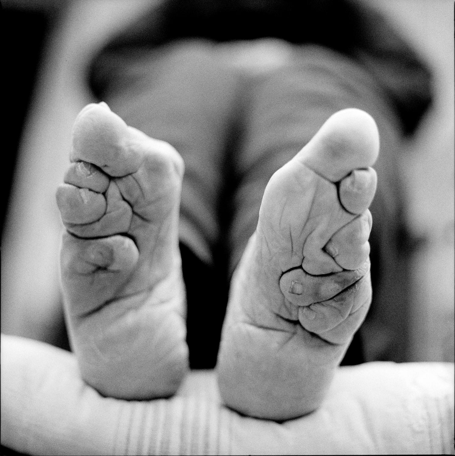 chinese foot binding