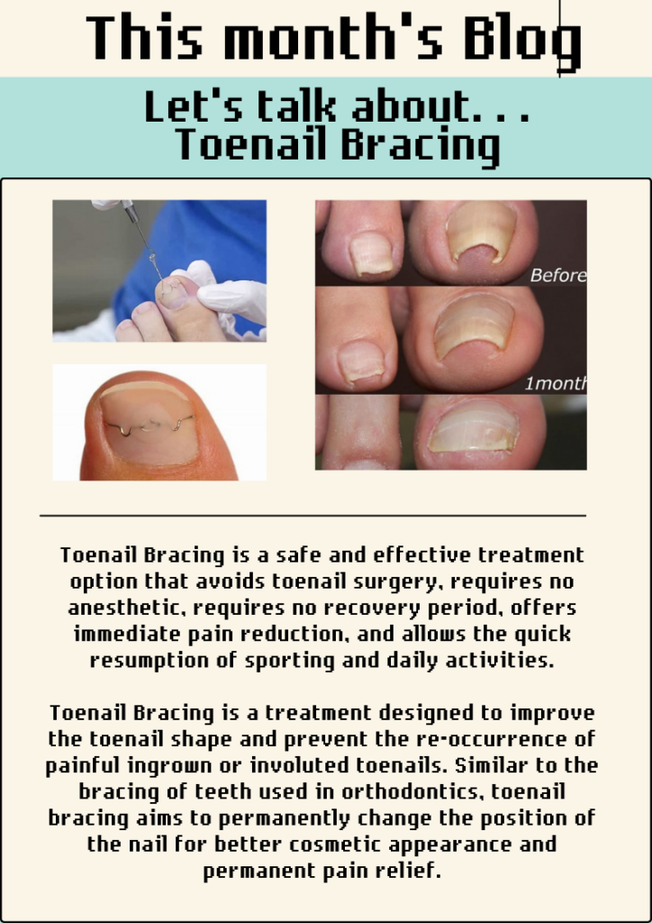 Image of ingrown toenails and afterwards using nail bracing